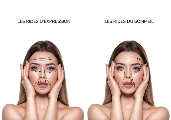 Les rides du sommeil ou LES RIDES D’EXPRESSION