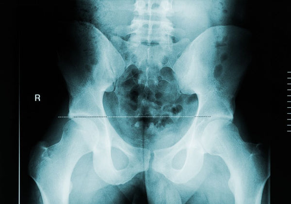 Fracture du coccyx: comment se rétablir? - Les coussins qui soulagent le  coccyx