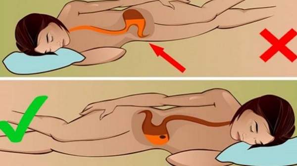 Dormir sur le côté droit peut provoquer une plus grande fuite d'acide dans l'œsophage.