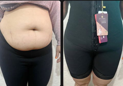 bellashaper levanta glúteos e barriga avental antes e depois