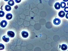 Ghost Cells Blood Sample