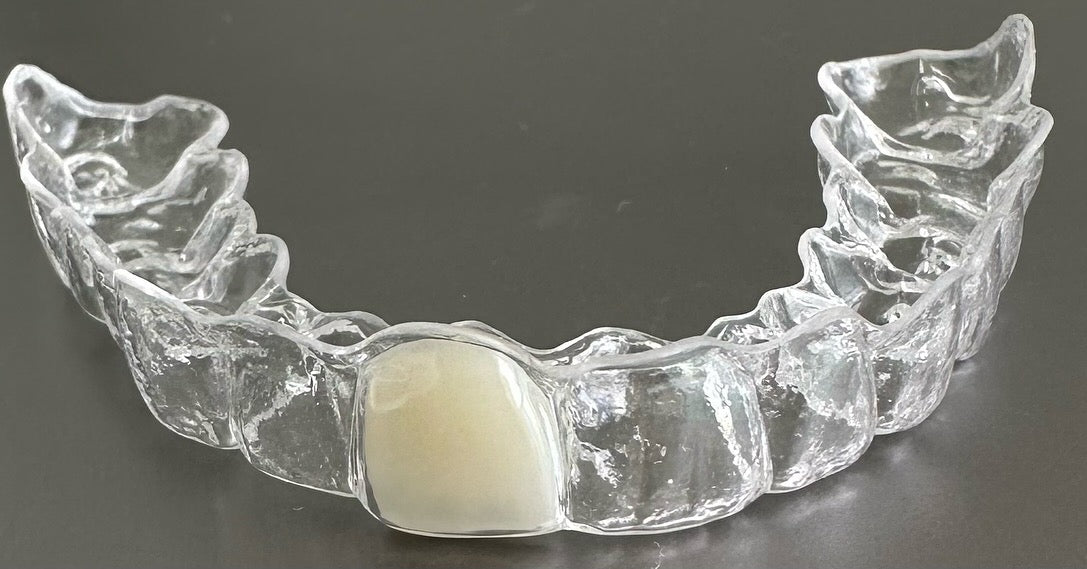 Essix Clear Retainer, Includes 1 Tooth