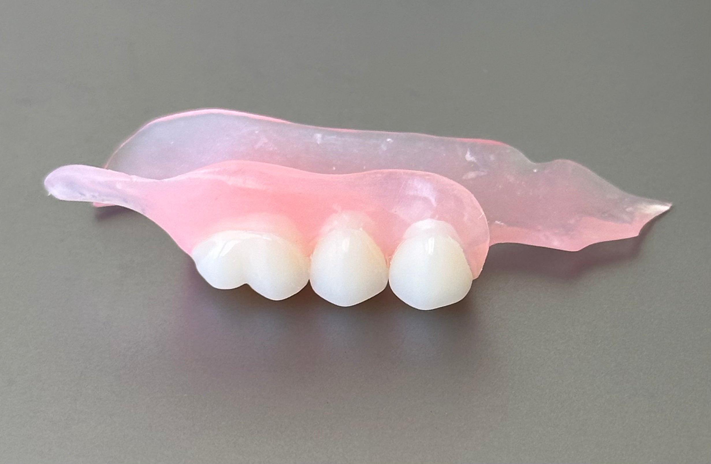 Flexible Partial Denture, Includes 1 tooth, Save $52 **** Use Code:TCG15 at checkout