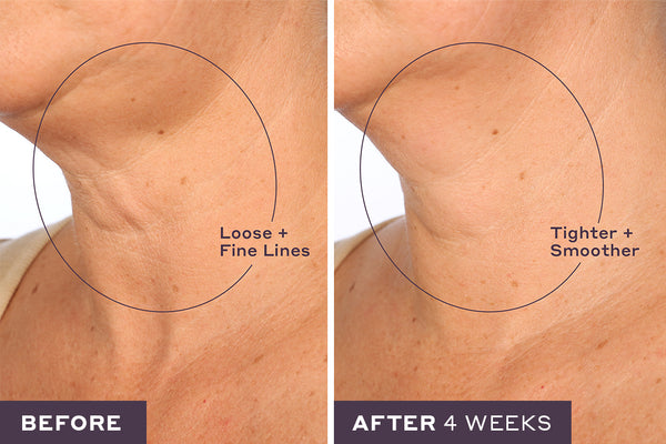 Let's Neck serum before and after results