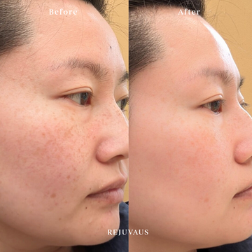 Pigmentation & Sun Damage