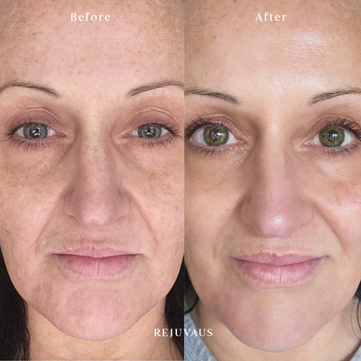 Before after anti aging serum