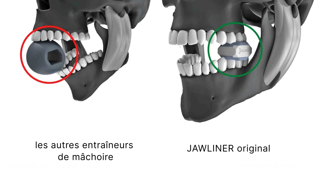 Pourquoi le JAWLINER® original n'est pas dangereux pour la santé – Jawliner  France