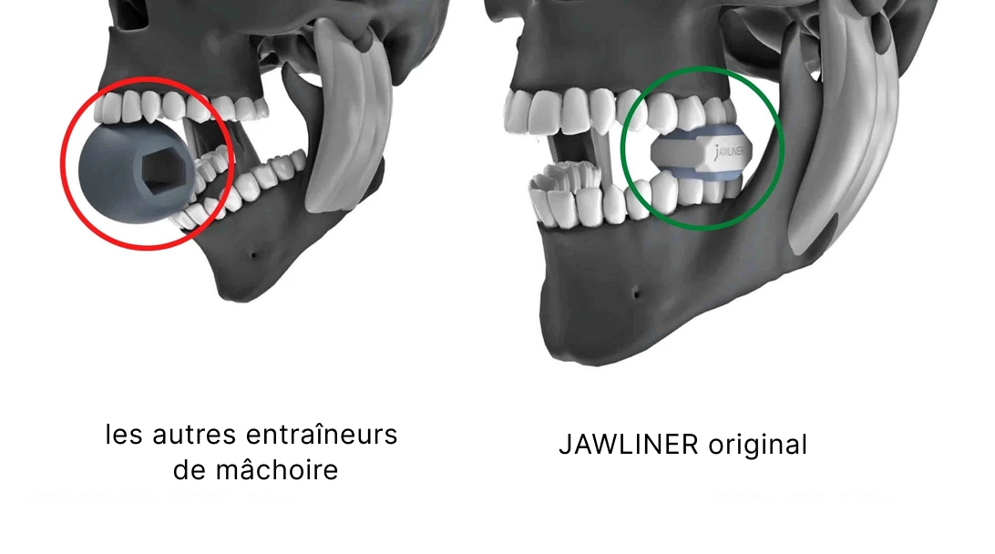 Quand et où utiliser les gommes de musculations pour la mâchoire ? 