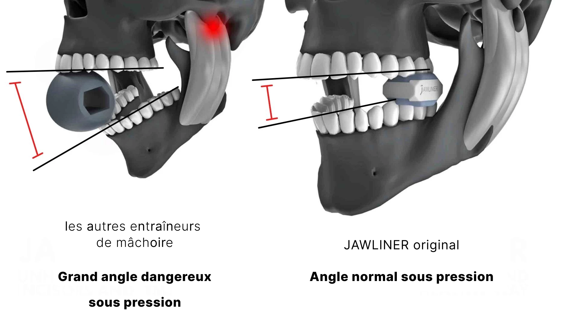 Pourquoi le JAWLINER® original n'est pas dangereux pour la santé