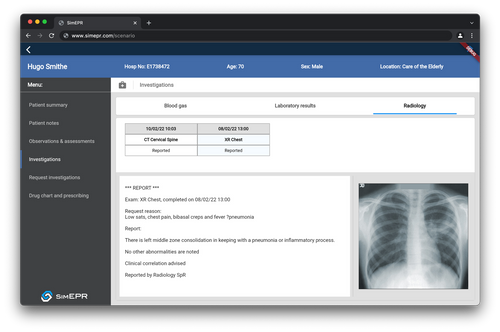 SimEPR Simulated Electronic Patient Record software showing an X-ray
