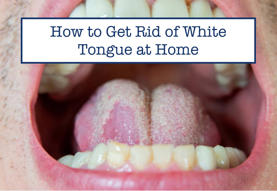 how-to-treat-tongue-blisters-naturally-home-remedies-for-tongue