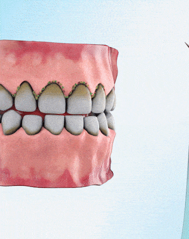 Brush_dent_electric_de_silicone_Para_calculo_dental_limpiar_de_dientes_electric_para_placa_de_manchas_de_dientes_de_sarro_de_calculo_dental