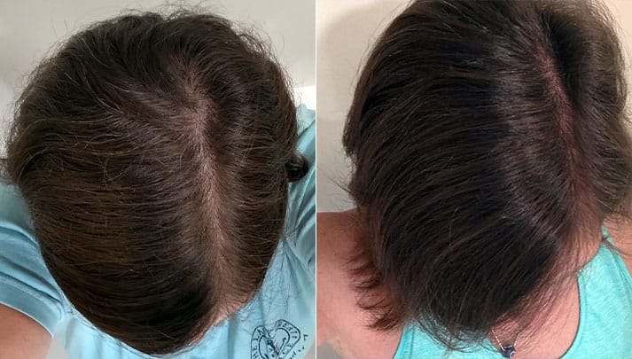 Briogeo Shampoo Before and After