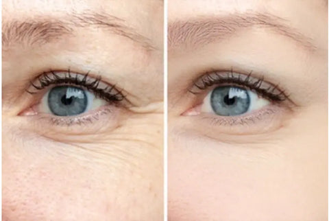 Image showing the positive effects of anti-wrinkle patches