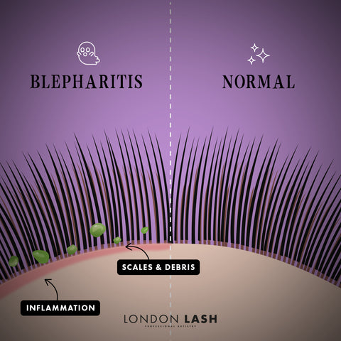 Halloween lash blepharitis graphic