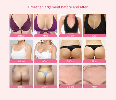Electric Breast Enlargement Vacuum Pump Therapy Body Massage