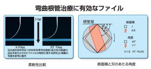 Rtファイル 31mm 15 40 アソート 6本入 マニー 歯科材料お買い物サイト メイプルショップ