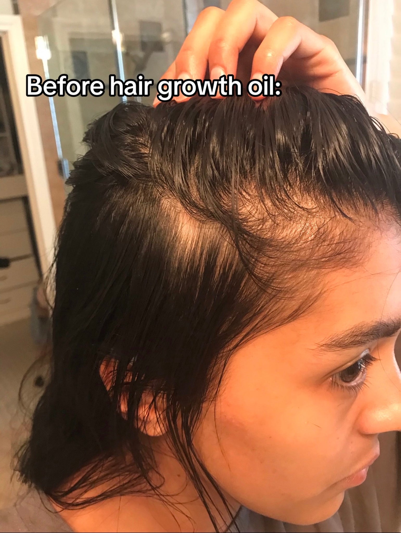 How To Use Castor Oil For Hair Growth