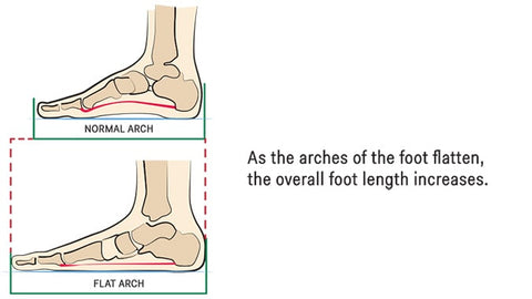 Feet & Age Changing Shoe Size