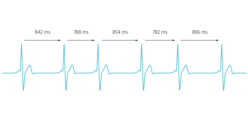 This Is How It Works Measure Stress With The Ecg Vitalmonitor