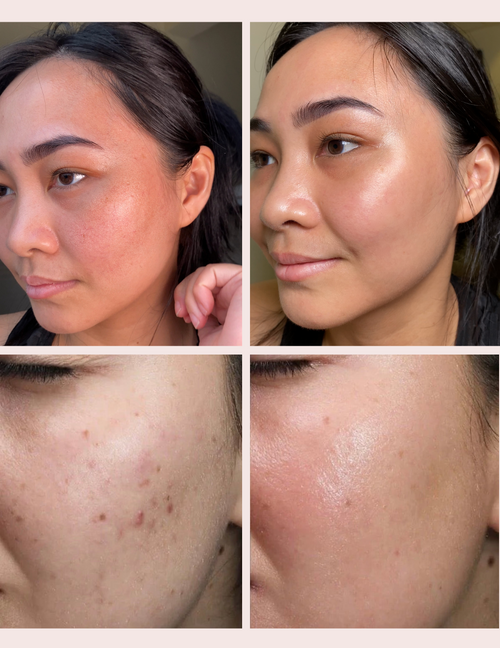 Helping you to reduce signs of aging and get plumper skin since 2019.png__PID:a7829666-c6f4-4ec4-beb1-1e4bb8dbe06e