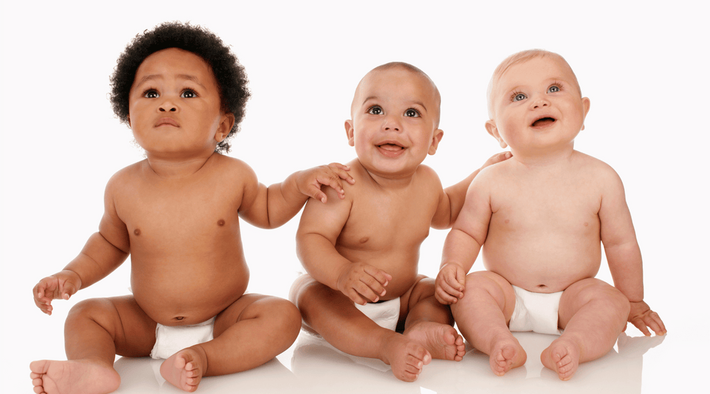 Managing Neonatal Psoriasis - 3 curious babies sitting beside each other in their diapers and staring up at something off camera. 