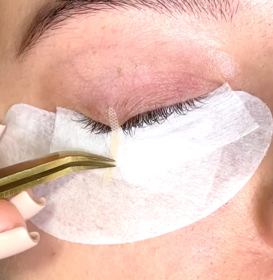 Placement of Eyelid Tape during Eyelash Extension Procedure
