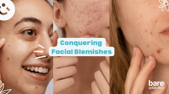 Picture of three girls with facial blemishes. Text: Conquering Facial Blemishes