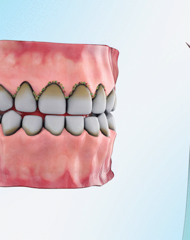 Pulizia dentale  Dentale Tartaro Rimozione – Farma Plus Italia