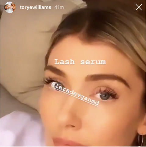 Torye Williams - Dr Devgan Lash Serum