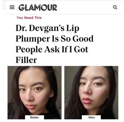 Glamour Magazine Dr Devgan Platinum Lip Plump