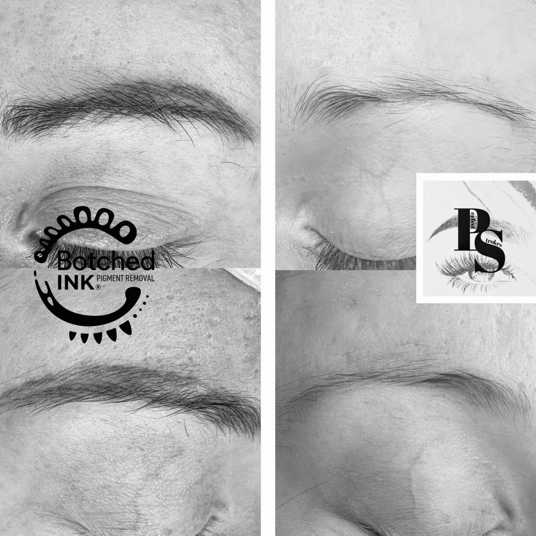 Tattooed Eyebrows Gone Wrong What Can Happen and What to Do