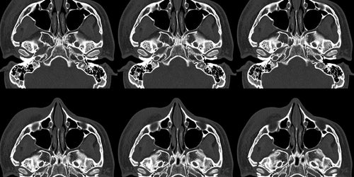 Radiografía de columna lumbar, 2 posiciones en Hospital San José