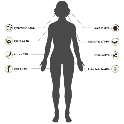 Trichotillomania