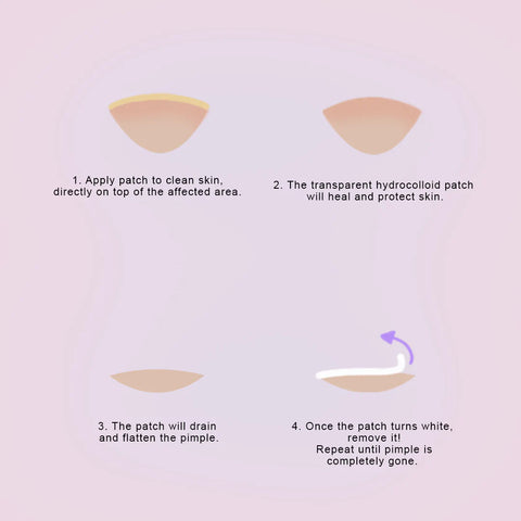 How Pimple Patches Do It