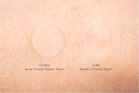 Korean Acne Spot Patches