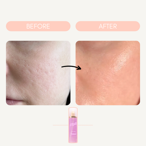 Before & After Dewy Glaze Toner