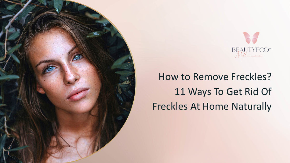 How To Remove Freckles At Home Naturally Beautyfoo Mall 1734