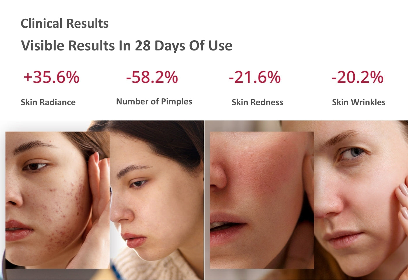 AMIRO LumoMax Clinical Results| Amiro Malaysia | BeautyFoo Mall Malaysia