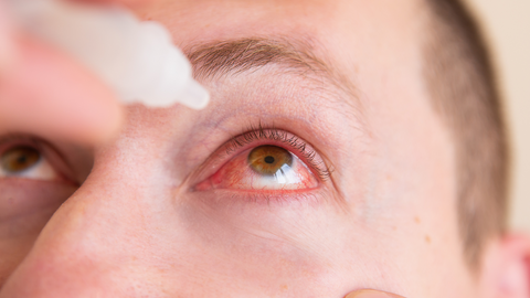 Eye drops are effective in treating redness and soothing irritated eyes