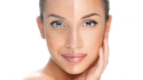 serum, benefits of serum, pigmentation, dull skin, dark spots