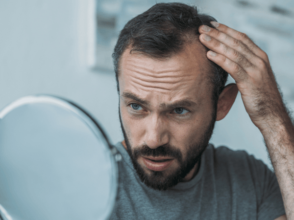 an image of a man getting bald