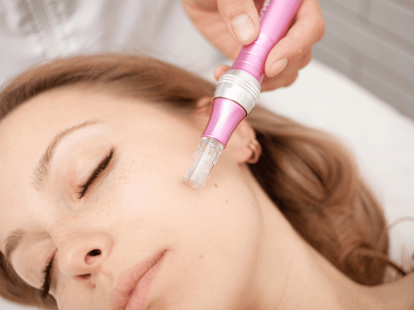 Benefits of Microneedling