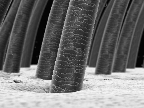 hair follicle close up