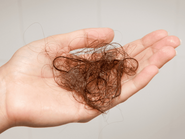 an image of a hand with a hands-full of fallen hair