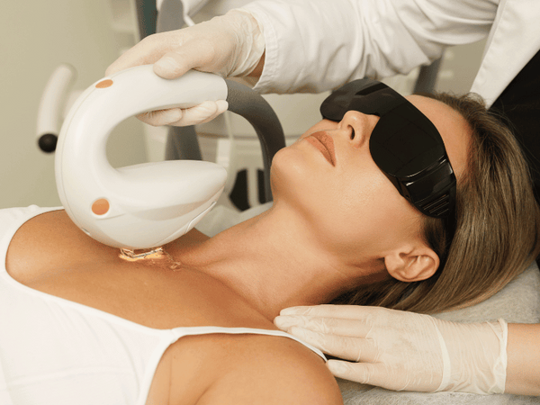 an image of a woman undergoing IPL treatment