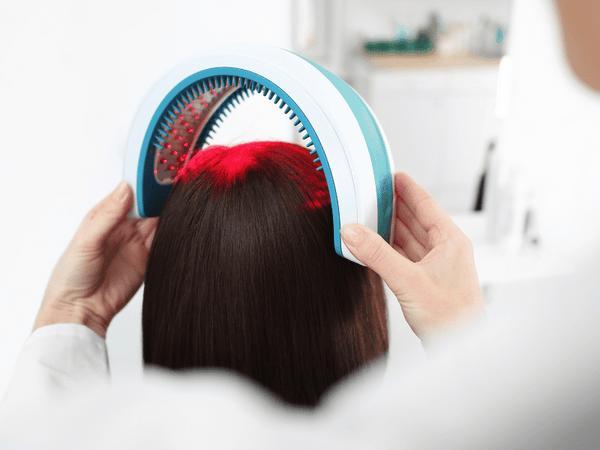 Low-Level Laser Therapy (LLLT) for scalp