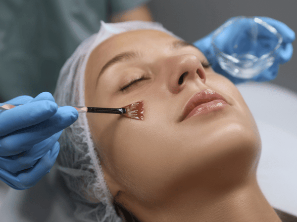 Microneedling vs. Chemical Peels