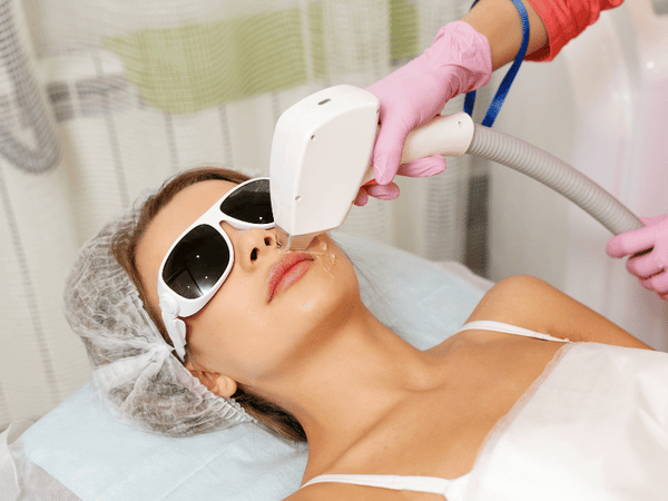 Microneedling vs. Laser Therapy