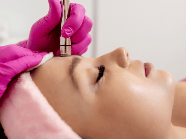 Microneedling vs. Microdermabrasion